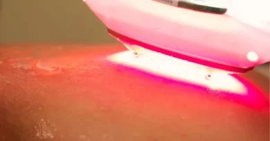 curso-de-laserterapia