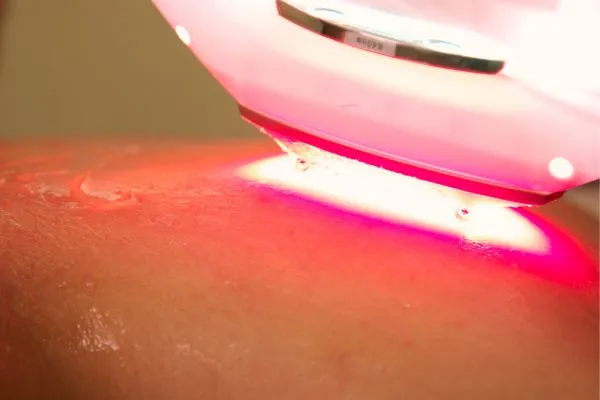 curso-de-laserterapia